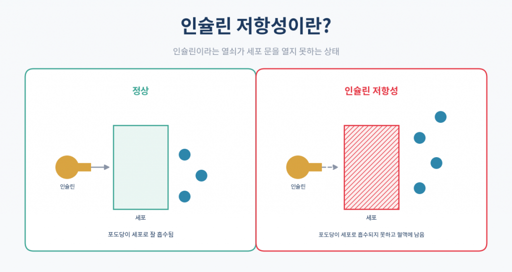 인슐린 저항성 개념 인포그래픽 세포 인슐린 열쇠