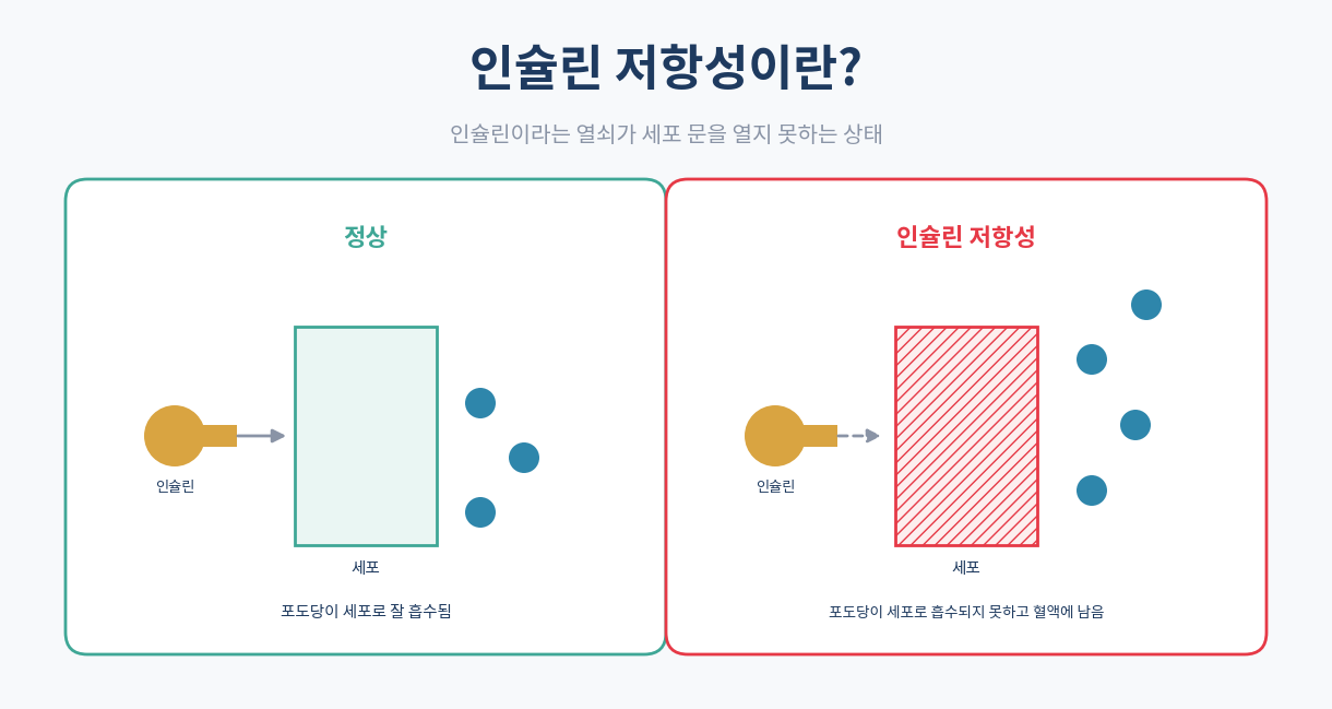 인슐린 저항성 개념 인포그래픽 세포 인슐린 열쇠