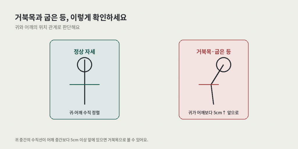 거북목과 굽은 등 교정이 필요한지 확인하는 진단 기준 — 정상 자세 vs 거북목·굽은 등 자세