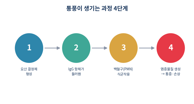 통풍 발생 기전 요산결정체 IgG 염증반응 4단계