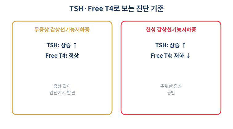 갑상선 기능저하증 TSH Free T4 진단 기준