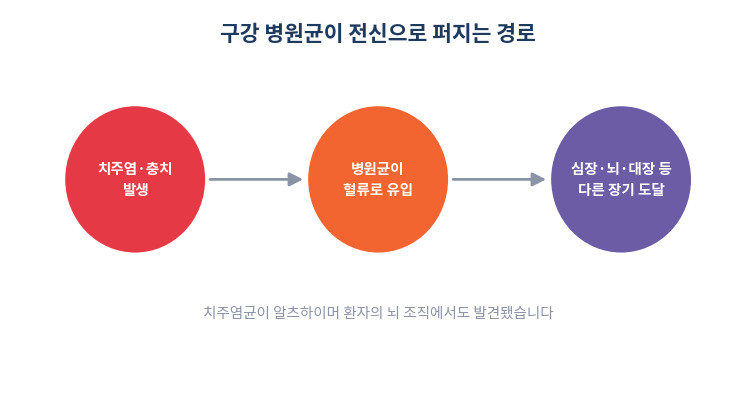 구강 병원균이 전신으로 퍼지는 경로